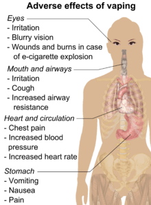 Adverse effects of vaping include throat irritation, cough, increased airway resistance, nausea, vomiting, chest pain, increased blood pressure, and increased heart rate.