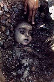The image of a deceased female child, victim of the Bhopal MIC gas leak