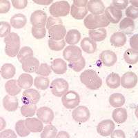 Microscope slide of small Leishmania amastigotes stained purple amongst cells