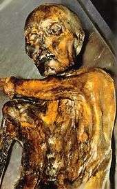 The Iceman from the chest up lying on stainless steel table, with his left arm across his body just between the top of his right shoulder and under his chin
