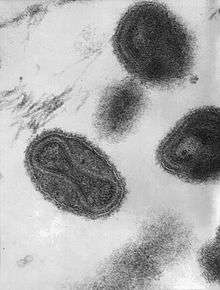 A picture of a virus